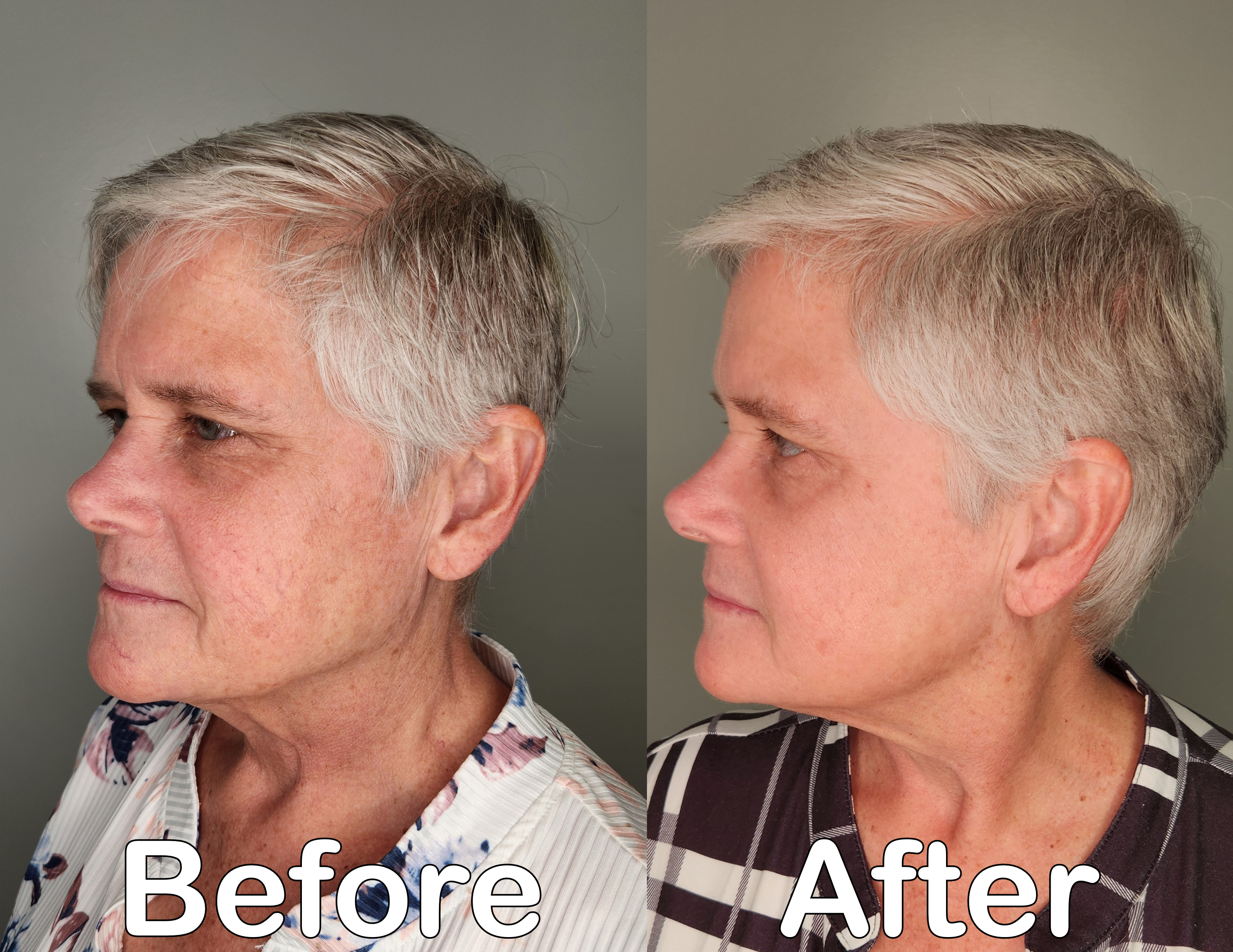 Before and after treatment