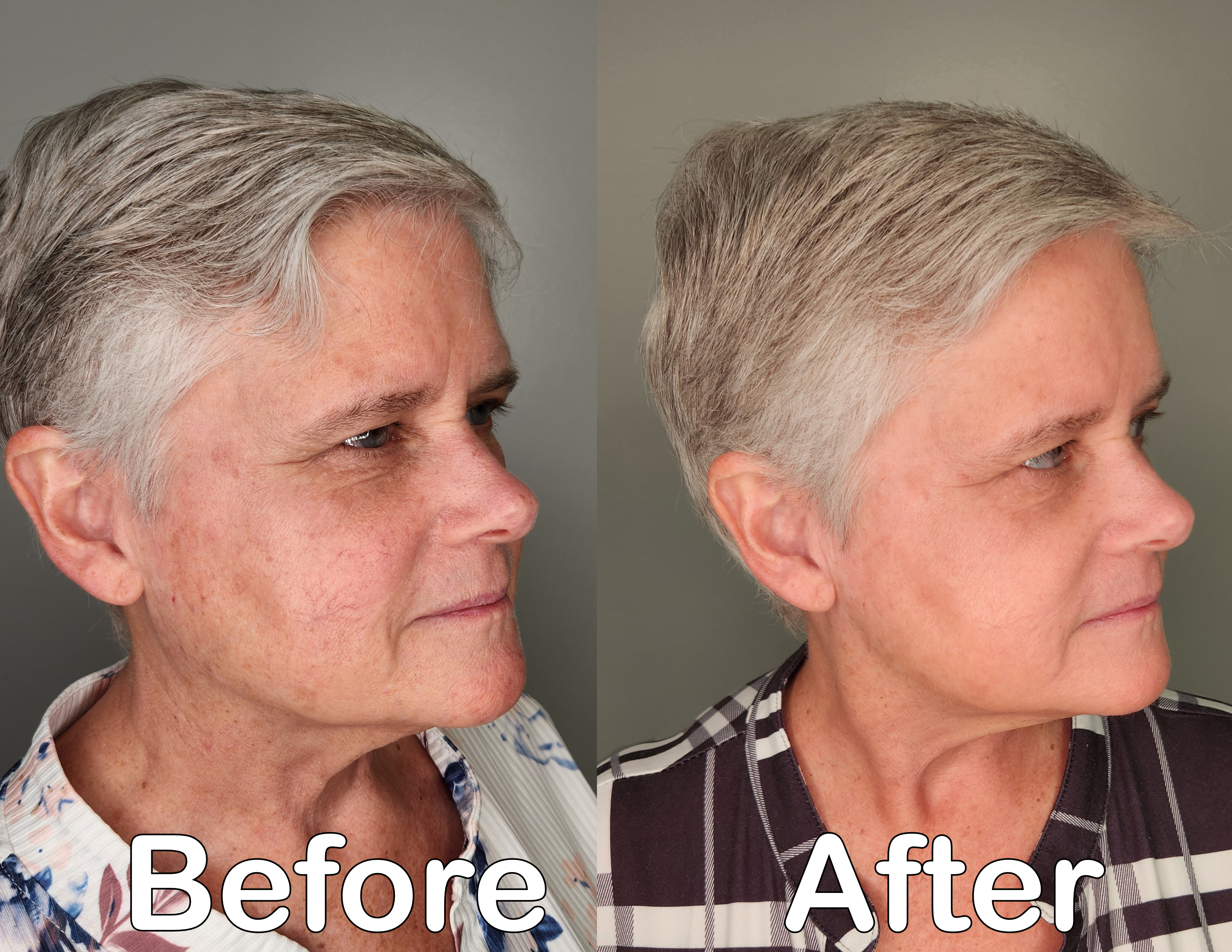 Before and after treatment
