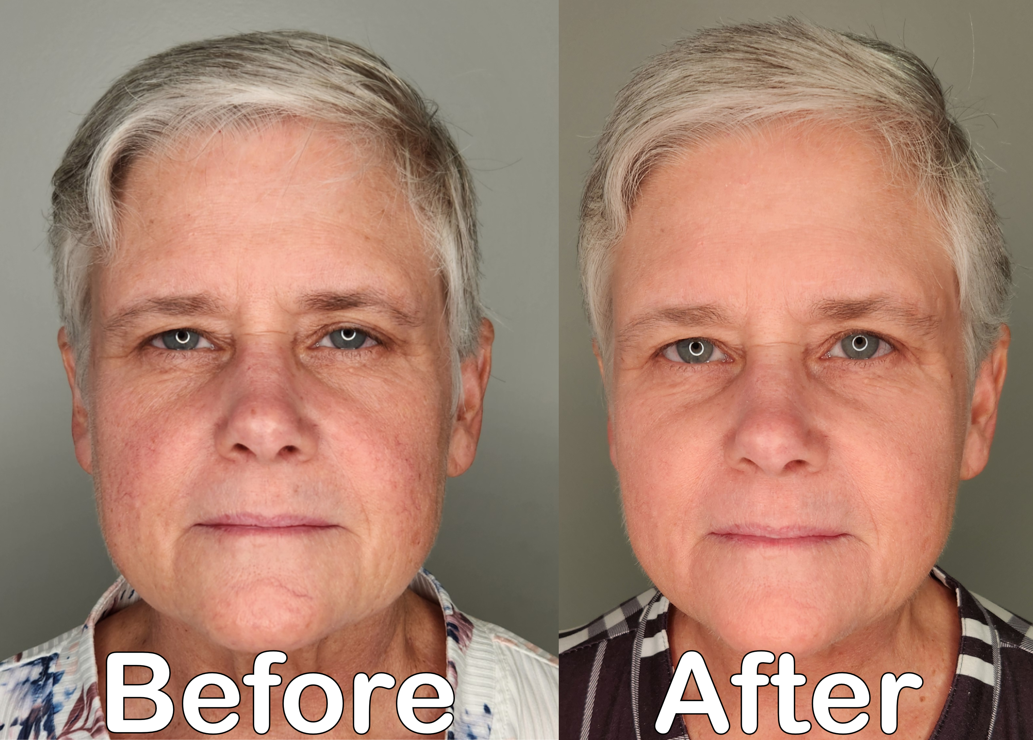 Before and after treatment